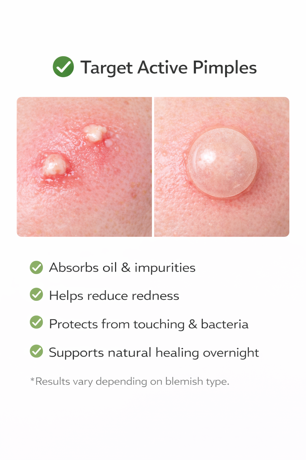 COSRX Acne Pimple Master Patch (24 Patches)